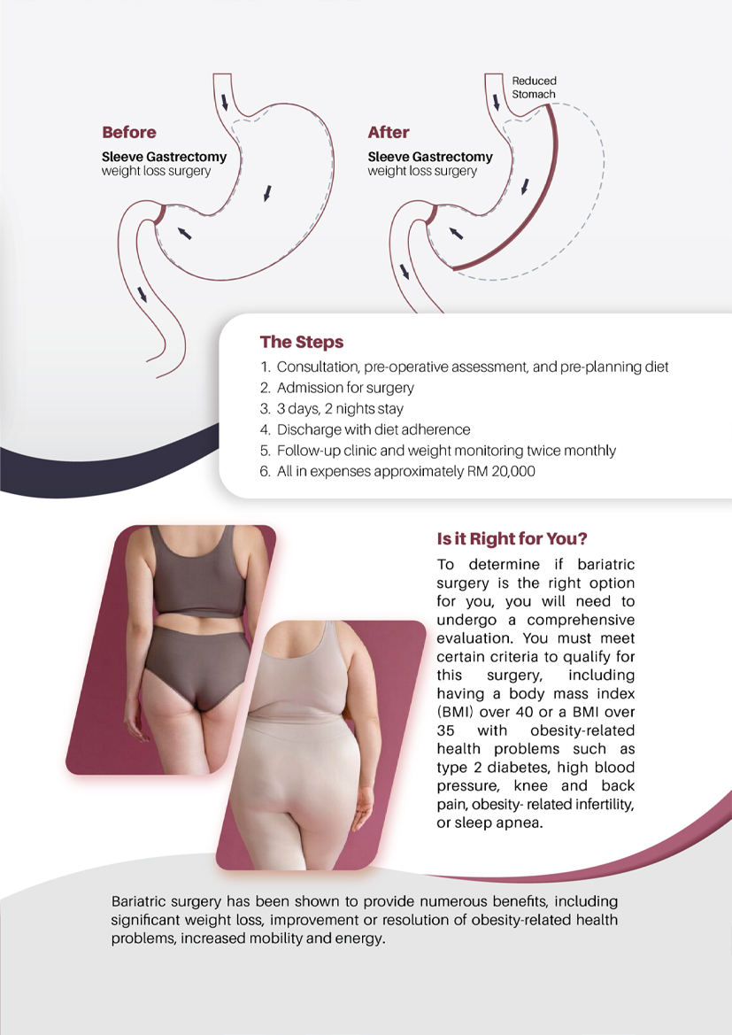 Bariatric Surgery has been shown to provide numerous benefits, including significant weight loss, improvement or resolution of obesity-related health problems, increased mobility and energy.